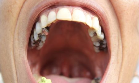 Suavinex SX PRO 0-6 m Birdies dudlík 2 ks - zelený