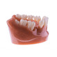 TePe Comunicator model problematických zubů
