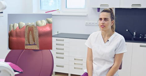 Ošetření zubních kanálků neboli endodoncie