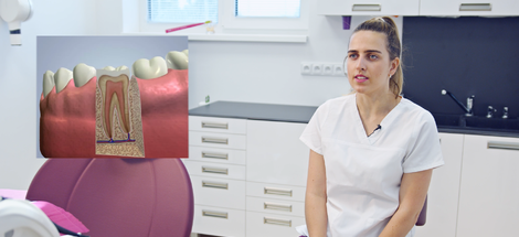 Ošetření zubních kanálků neboli endodoncie