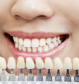 Co všechno ovlivňuje odstín zubů?