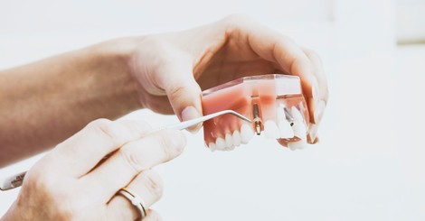 Zubní péče 2022: na co vám pojišťovna (ne)přispěje