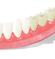 3 typy bělení zubů – jak šetrně získat bílý úsměv?