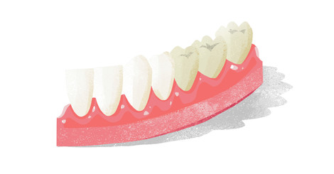 3 typy bělení zubů – jak šetrně získat bílý úsměv?