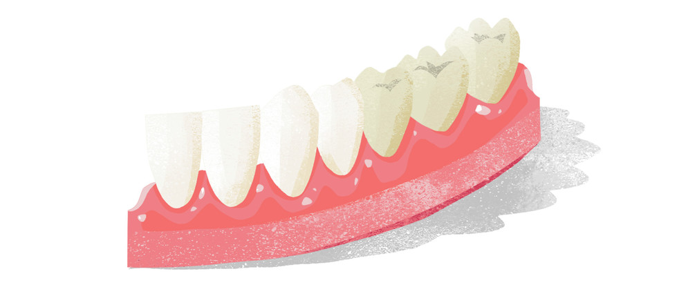Vyzrajte na nepěkný odstín zubů jednou provždy.
