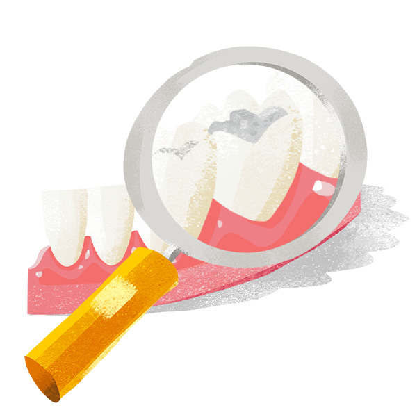 ilustrace fotokompozitní výplň