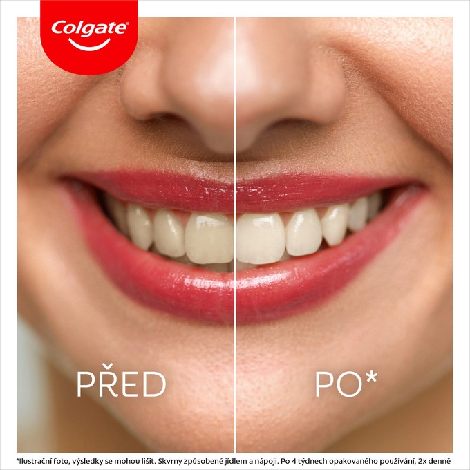 Colgate Max White Ultra MultiProtect bělicí zubní pasta 50 ml