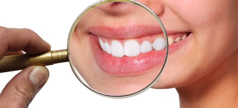 Na co se nejčastěji ptáte o bělení zubů