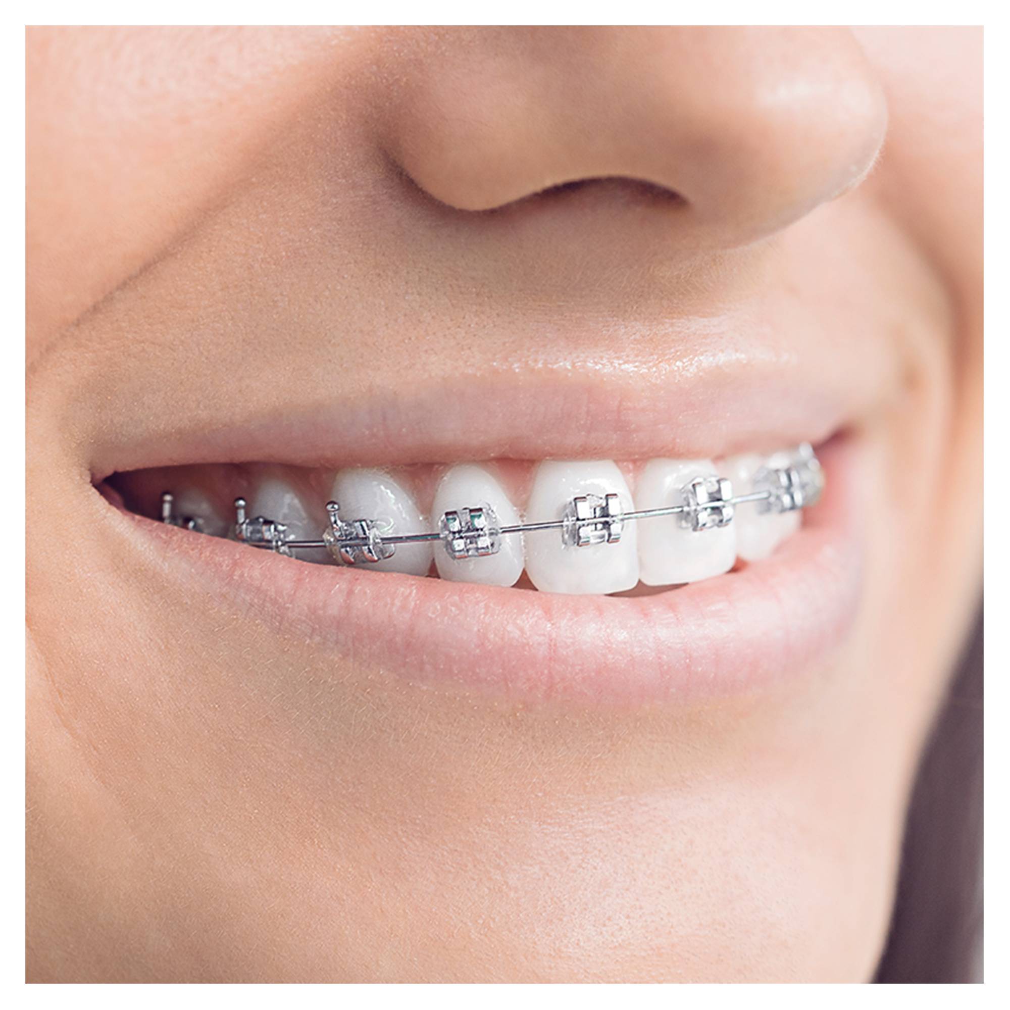 Oral-B OrthoCare Essentials náhradní hlavice 3 ks