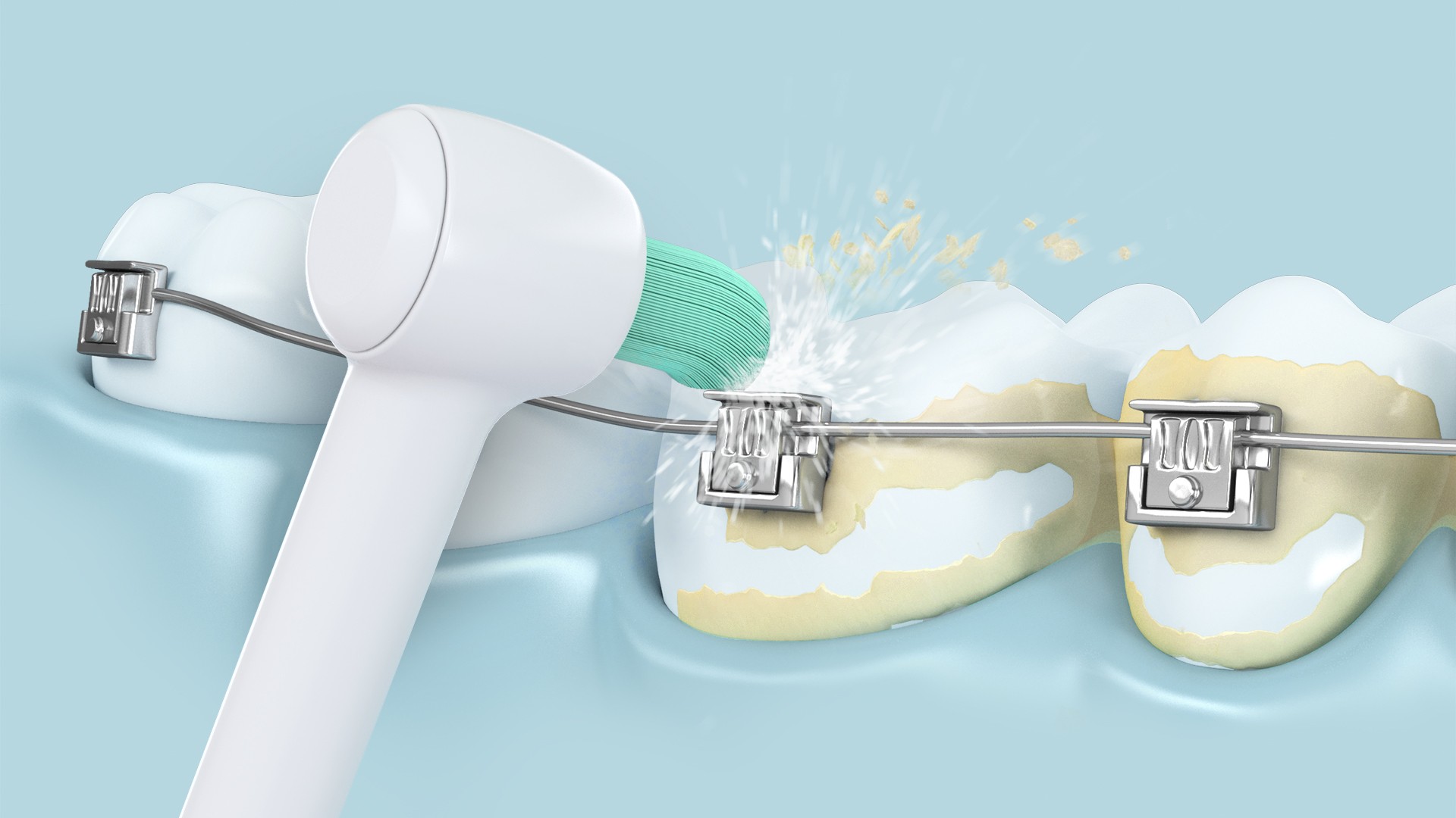 Panasonic WEW0984W303 náhradní tryska 2 ks