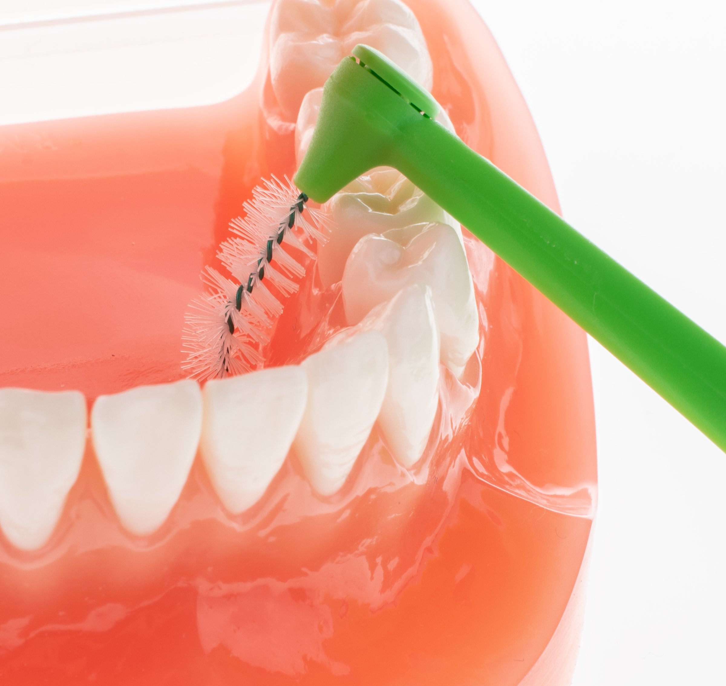 TePe Multipack ANGLE 0,80 mezizubní kartáčky zelené 25 ks