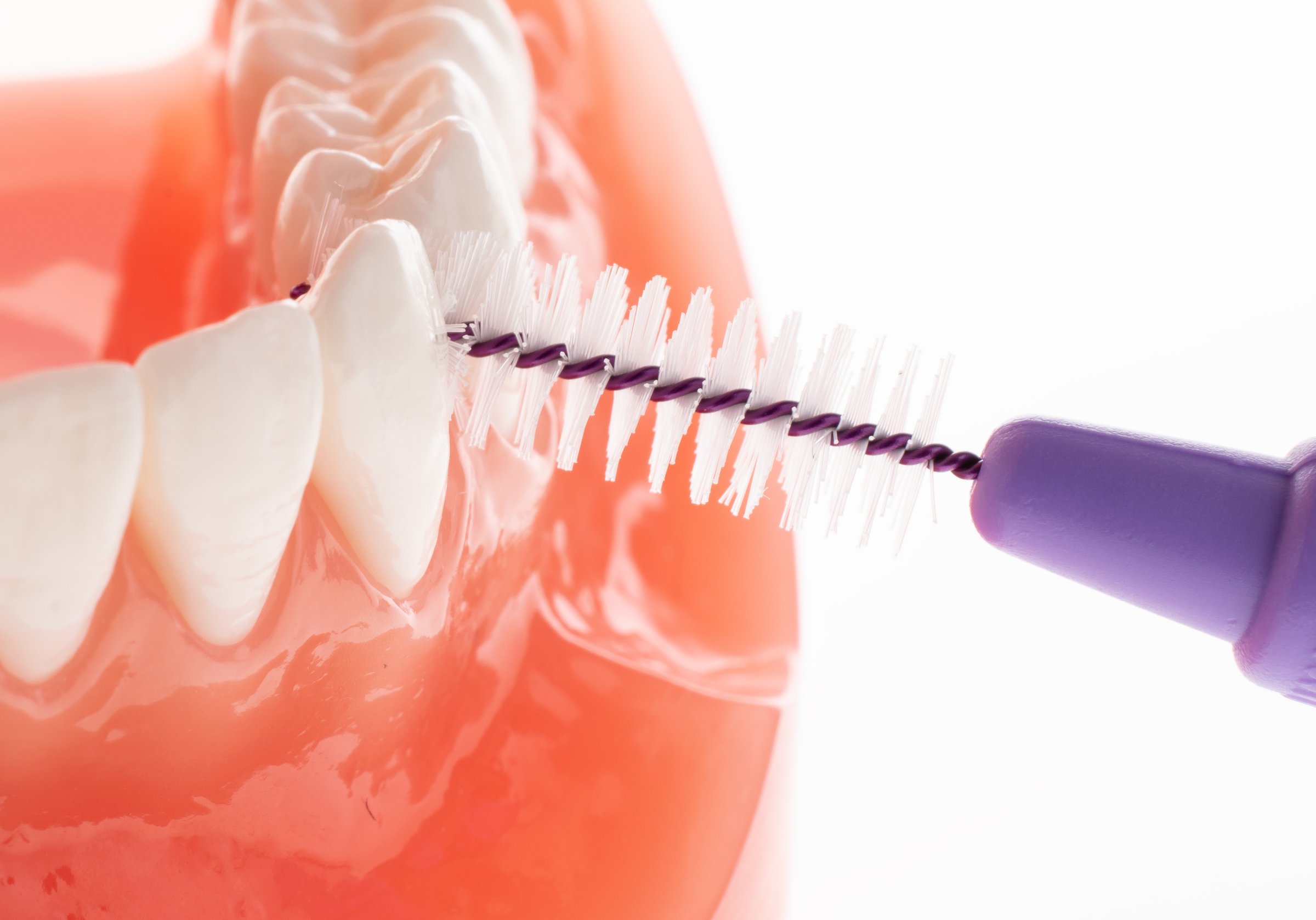 TePe Multipack 1,10 mezizubní kartáčky fialové 25 ks