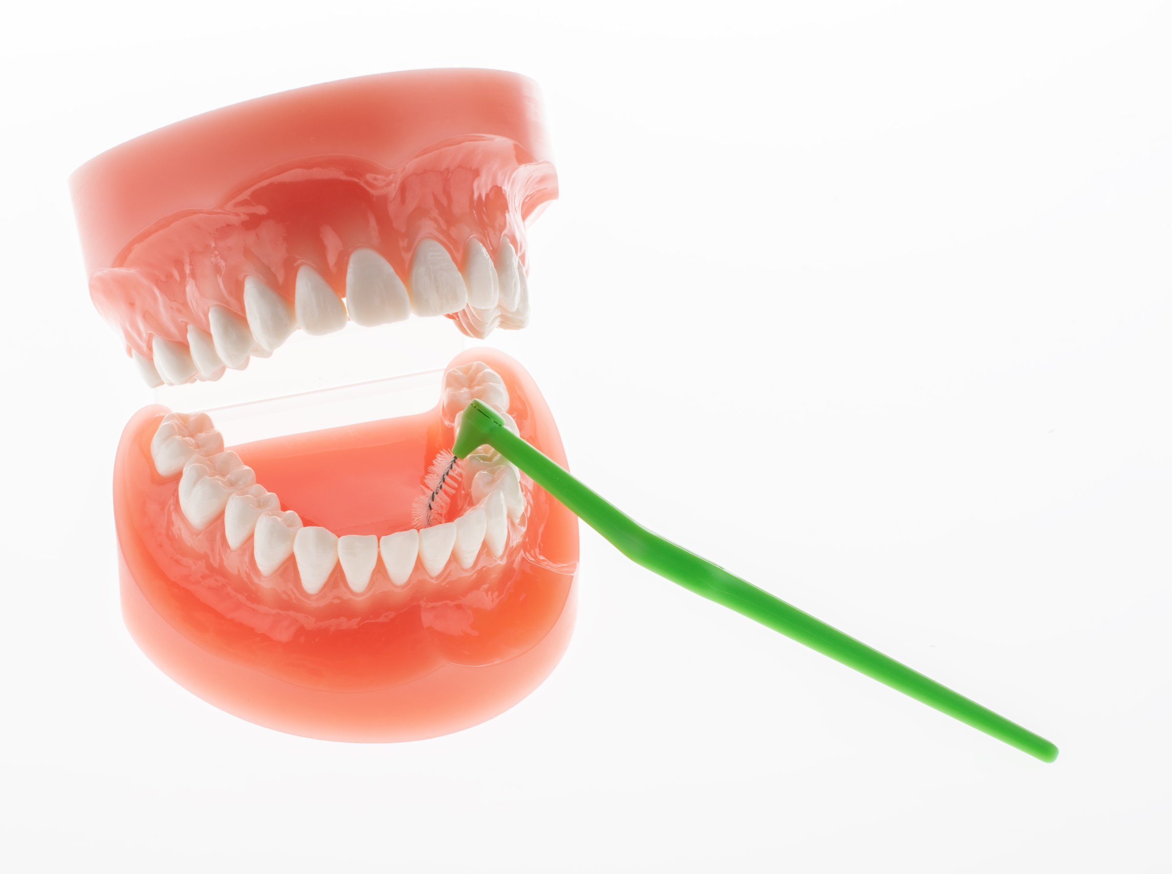 TePe Multipack ANGLE 0,80 mezizubní kartáčky zelené 25 ks