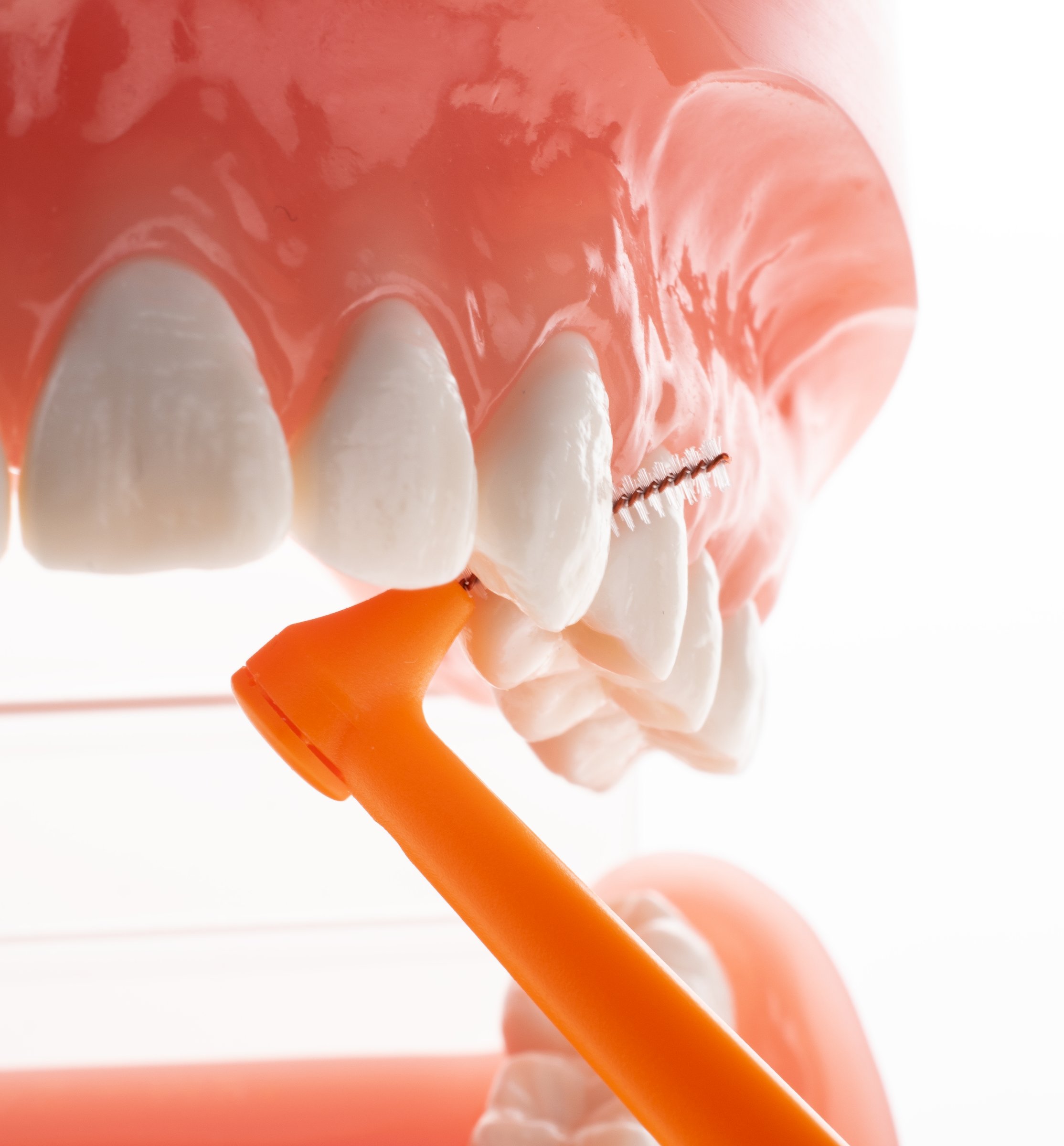 TePe Multipack ANGLE 0,45 mezizubní kartáčky oranžové 25 ks