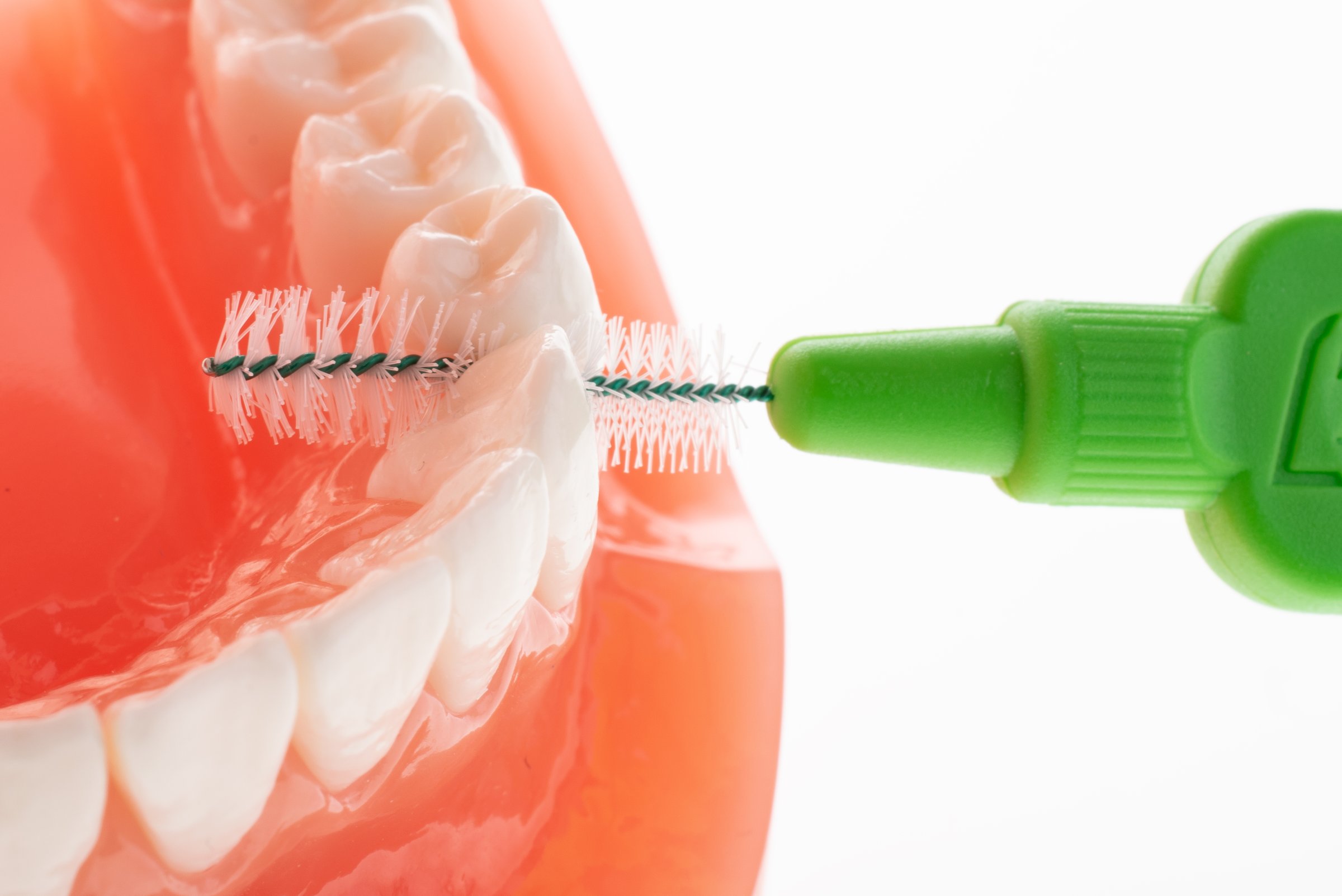 TePe Multipack 0,80 mezizubní kartáčky zelené 25 ks