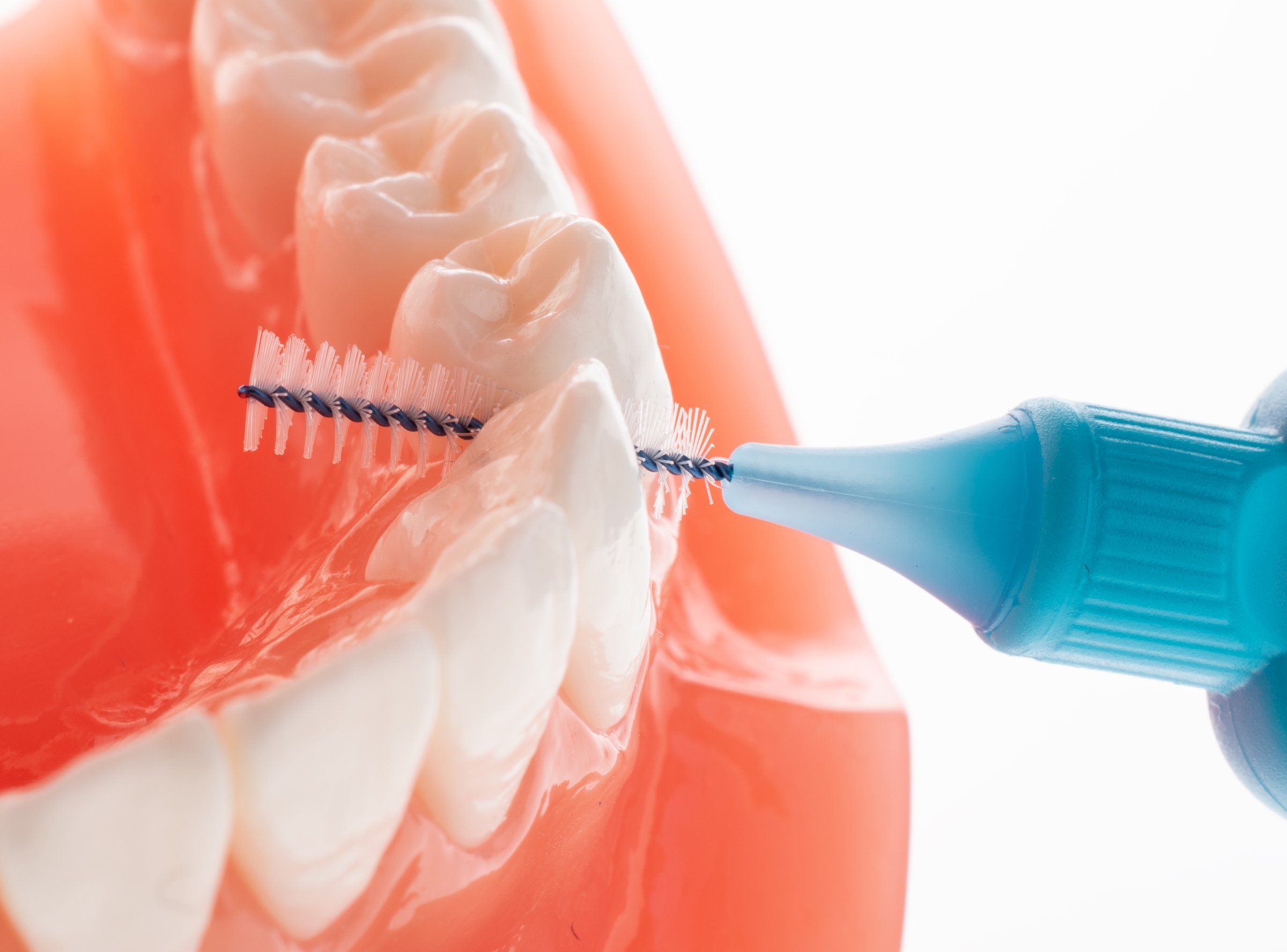 TePe Multipack 0,60 mezizubní kartáčky modré 25 ks