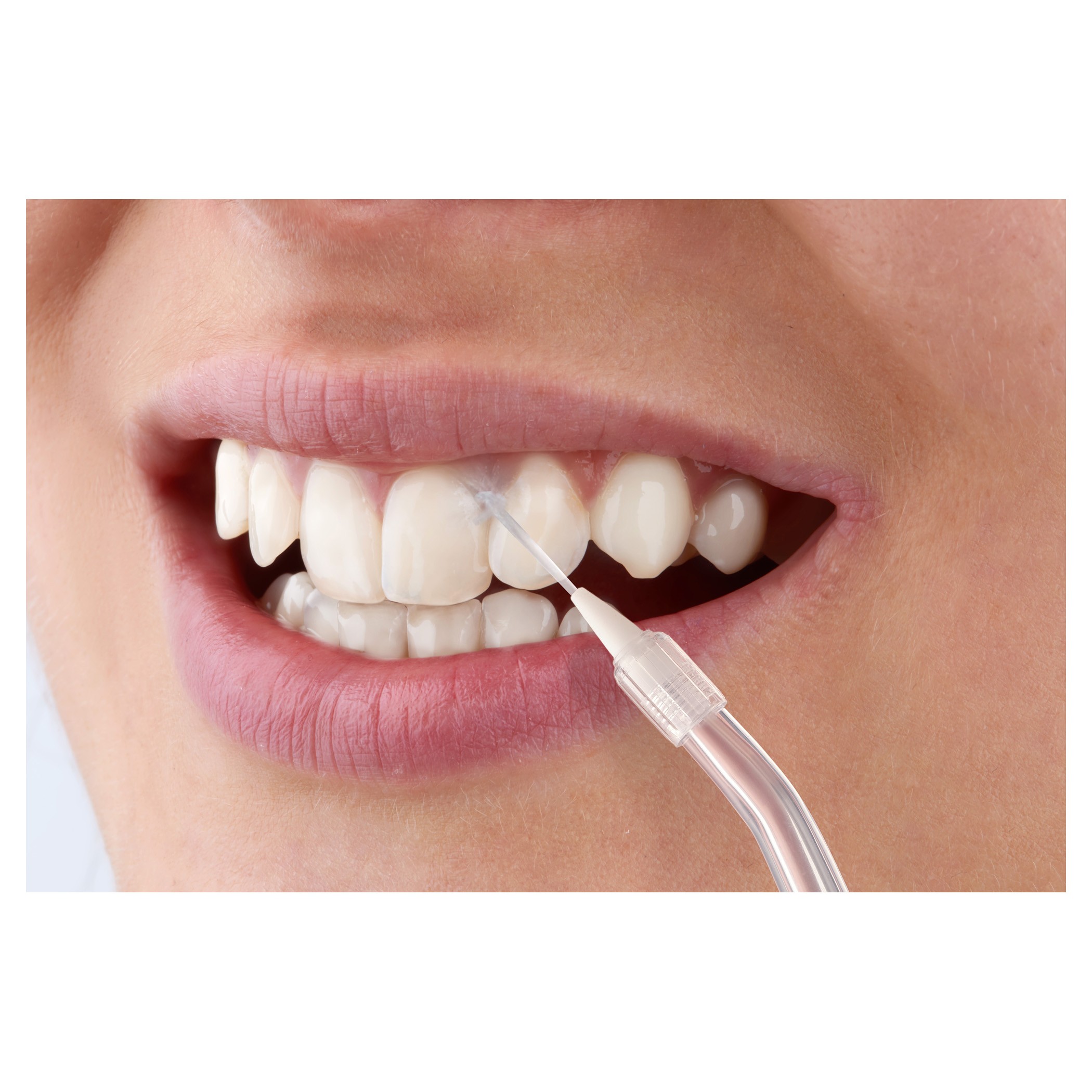 Sencor SOI 1311GD cestovní ústní sprcha