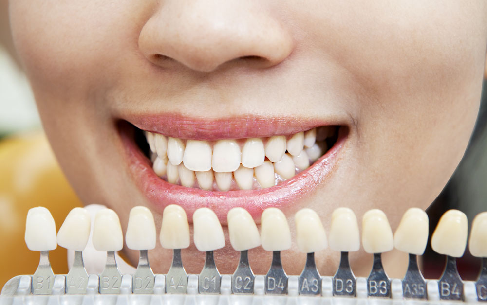 Co ovlivnuje barvu zubu?